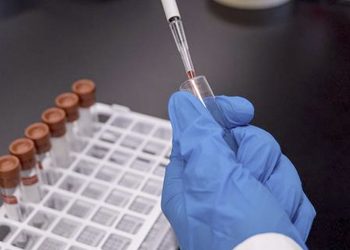 España ha realizado más de tres millones de PCR desde el inicio de la epidemia