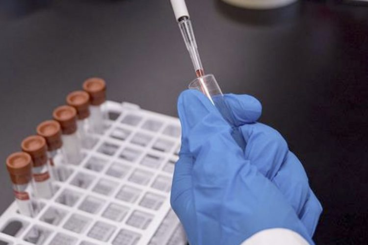 España ha realizado más de tres millones de PCR desde el inicio de la epidemia