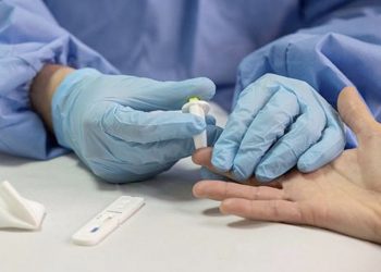 El CSIC logra un test de anticuerpos que detecta la inmunidad frente a COVID-19 con más del 98% de fiabilidad