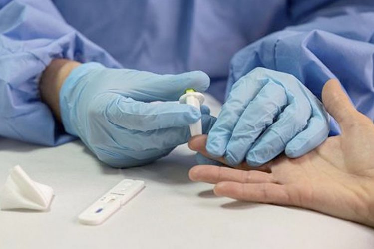 El CSIC logra un test de anticuerpos que detecta la inmunidad frente a COVID-19 con más del 98% de fiabilidad