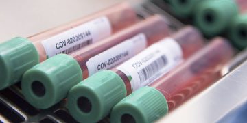 La OMS se fija finales de 2021 para conseguir 2000 millones de vacunas contra el COVID-19