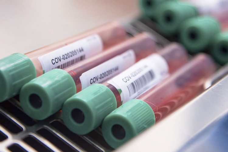 La OMS se fija finales de 2021 para conseguir 2000 millones de vacunas contra el COVID-19