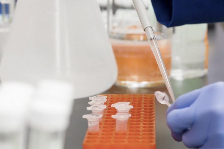 Más de un millón de muertos por coronavirus en el mundo